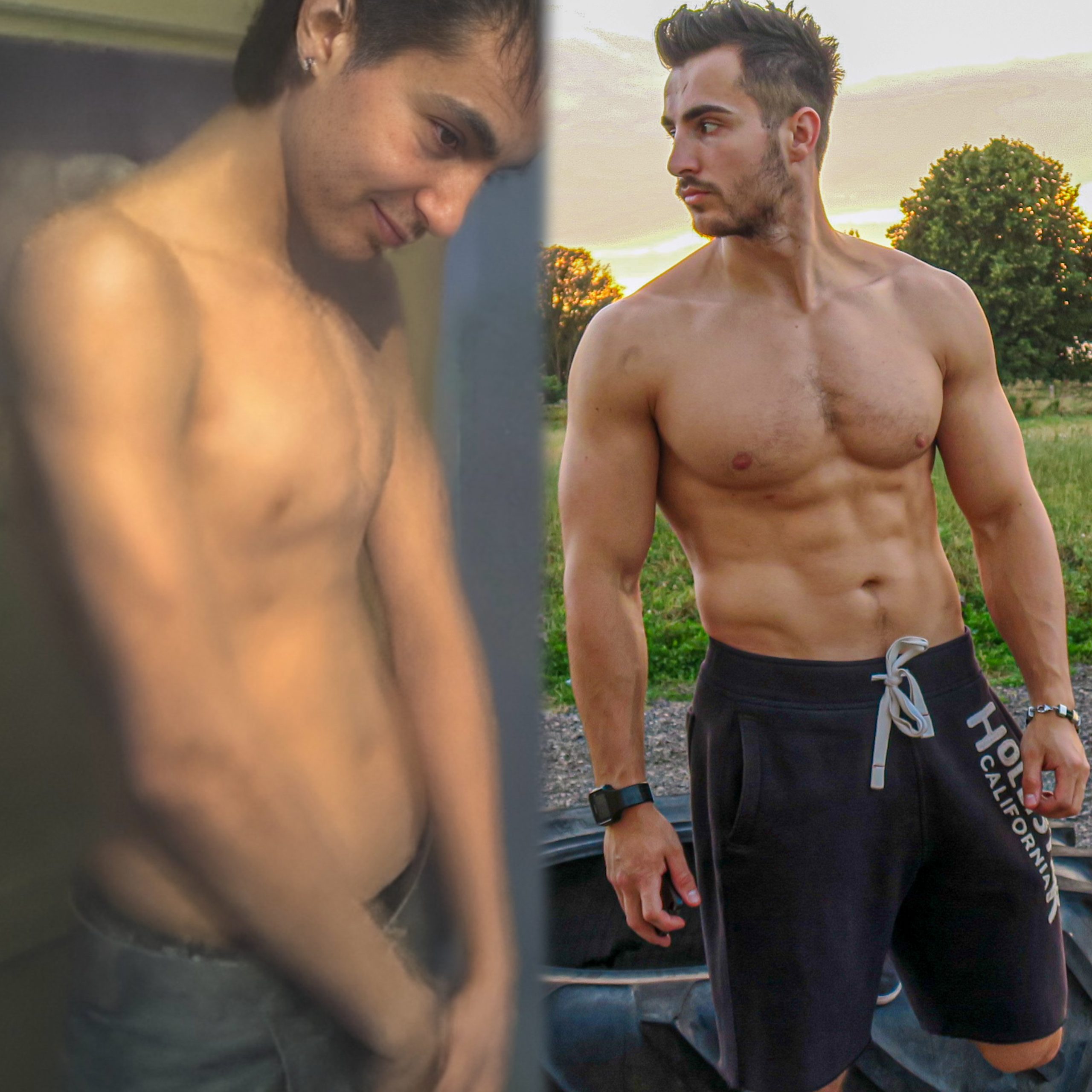 Pectus Fixer before and after chest transformation